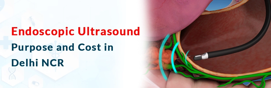 Endoscopic Ultrasound: Purpose and Cost in Delhi NCR